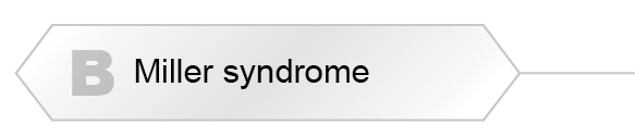 The Answer Is B -  Miller syndrome